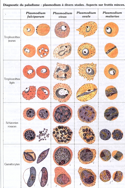 découvrez les conséquences d'un diagnostic parasitaire : comment les parasites affectent votre santé, les symptômes à surveiller et les traitements disponibles pour y remédier.