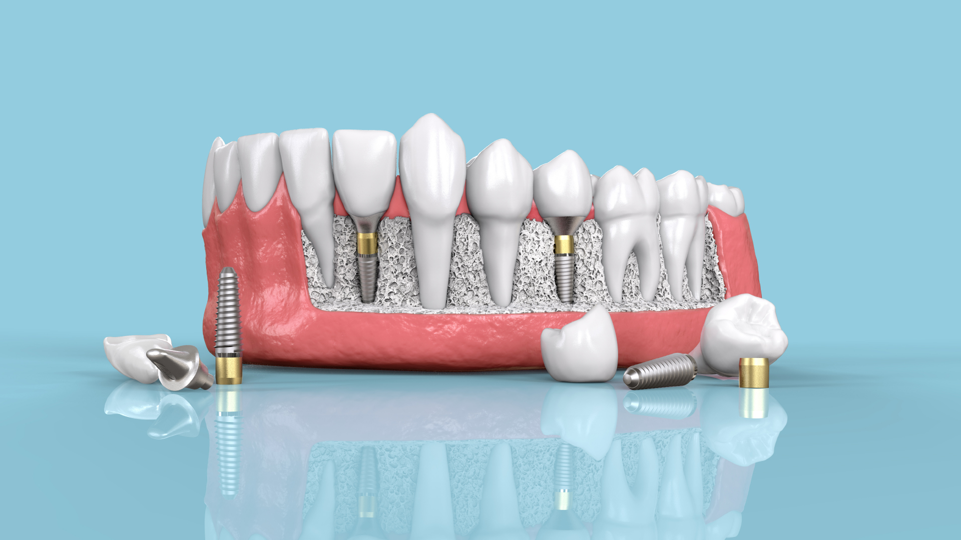 découvrez comment optimiser vos leads pour les mutuelles santé et complémentaires dentaires. profitez de conseils pratiques pour attirer et fidéliser vos clients tout en offrant des services adaptés à leurs besoins en santé et en dentisterie.