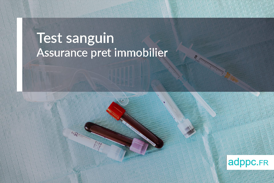 découvrez comment optimiser votre assurance prêt pour bénéficier des meilleures conditions et réduire vos coûts. des conseils pratiques pour un financement sécurisé et avantageux.